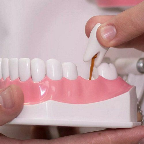 Когда необходима замена зуба металлокерамическим протезом
