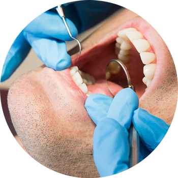 Осложнения после лечения зубов