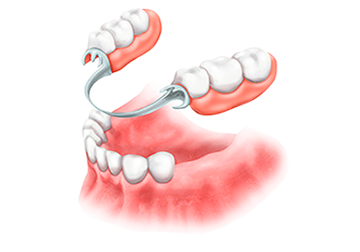 Детское Зубное Протезирование Ортодонтия Реферат