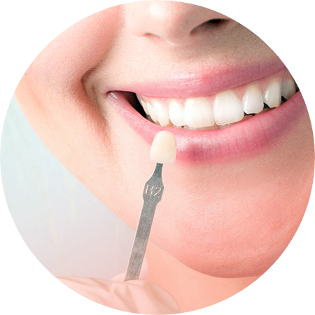 Использование виниров в стоматологии актуально, когда у пациента наблюдаются