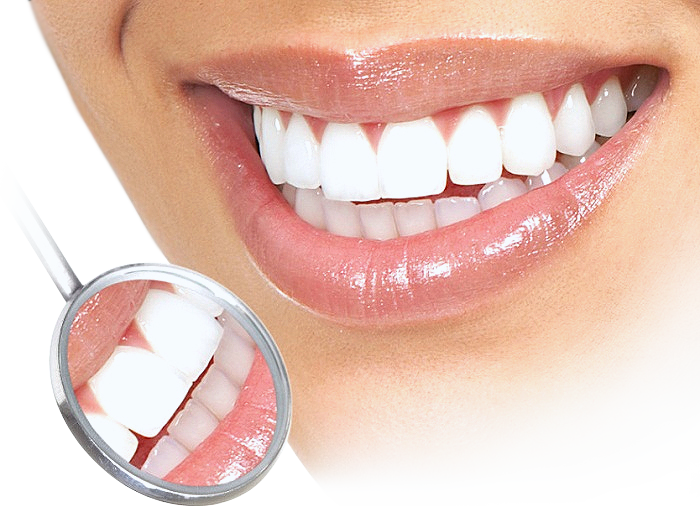 Что нужно знать, чтобы отбелить зубы быстро, безопасно и эффективно?