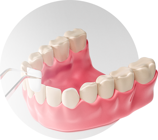 Восстановление зубов в стоматологии ИНТАН