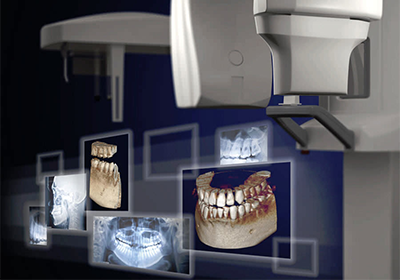 Области применения компьютерной томографии зубов