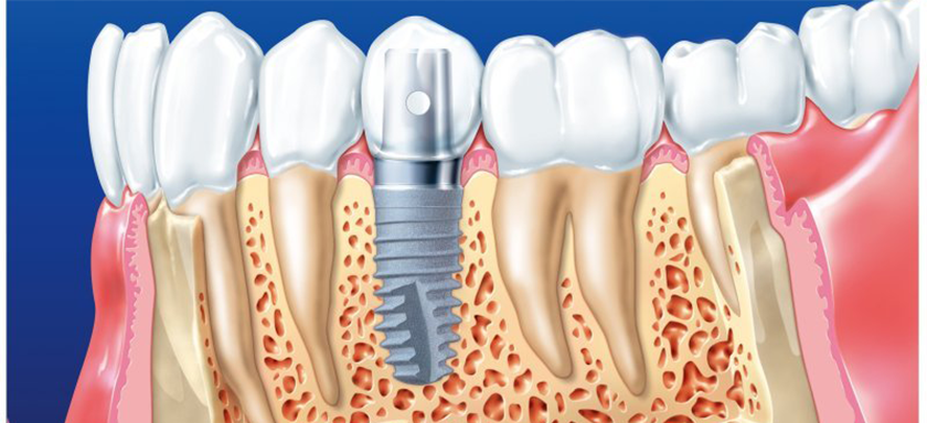 Современная стоматология располагает
